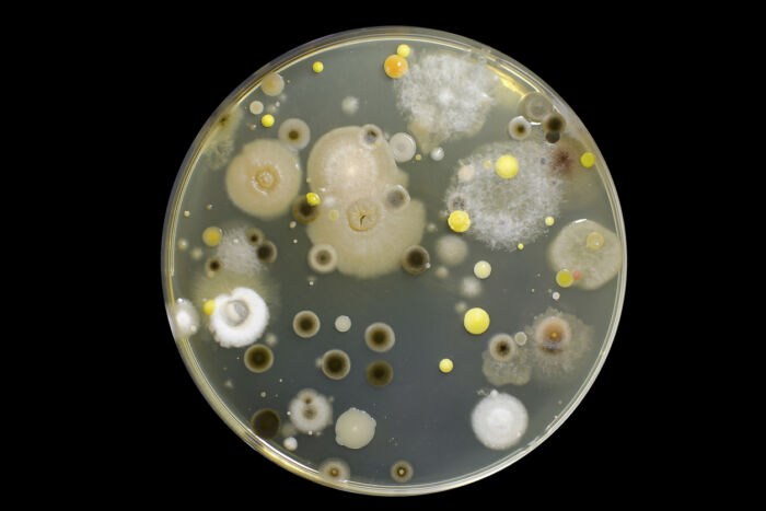 bacteria cultures in a petri dish